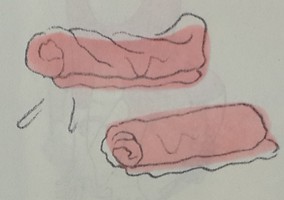 減壓瑜伽-胃部不適時