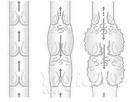 如何用瑜伽法來治療靜脈曲張？